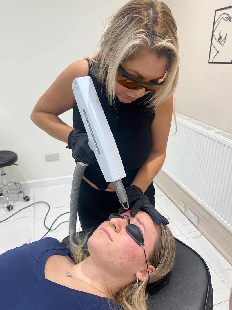 Laser Tattoo Removal